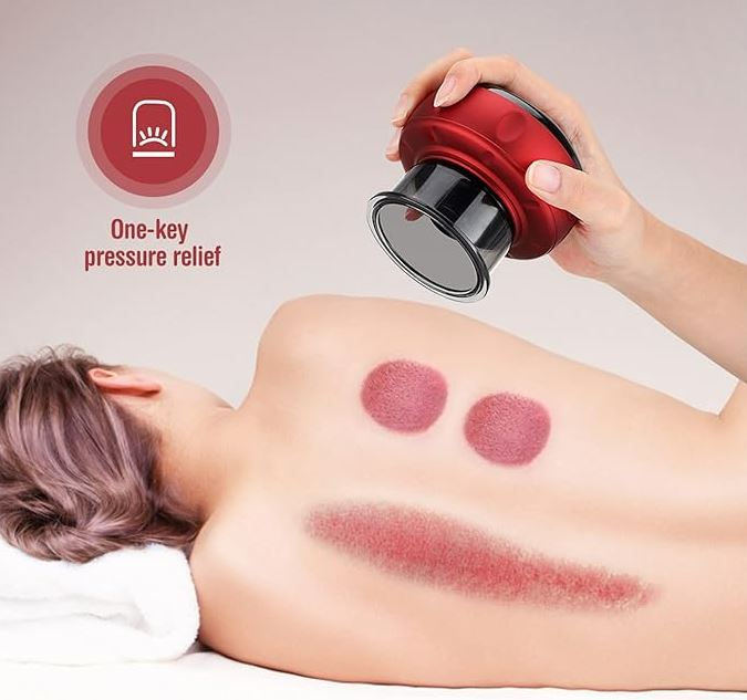 The Ultimate Smart Cupping Massager - Koyers