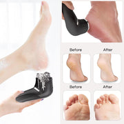 Rechargeable Electric Foot Scrubber – LCD Callus Remover with Vacuum & Waterproof Design