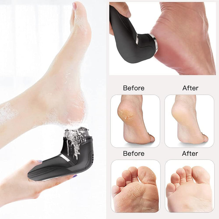 Rechargeable Electric Foot Scrubber – LCD Callus Remover with Vacuum & Waterproof Design