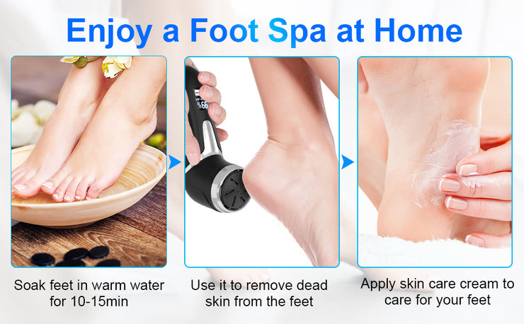 Rechargeable Electric Foot Scrubber – LCD Callus Remover with Vacuum & Waterproof Design