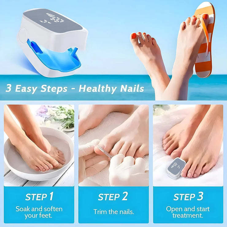 Rechargeable LED Nail Fungus Remover