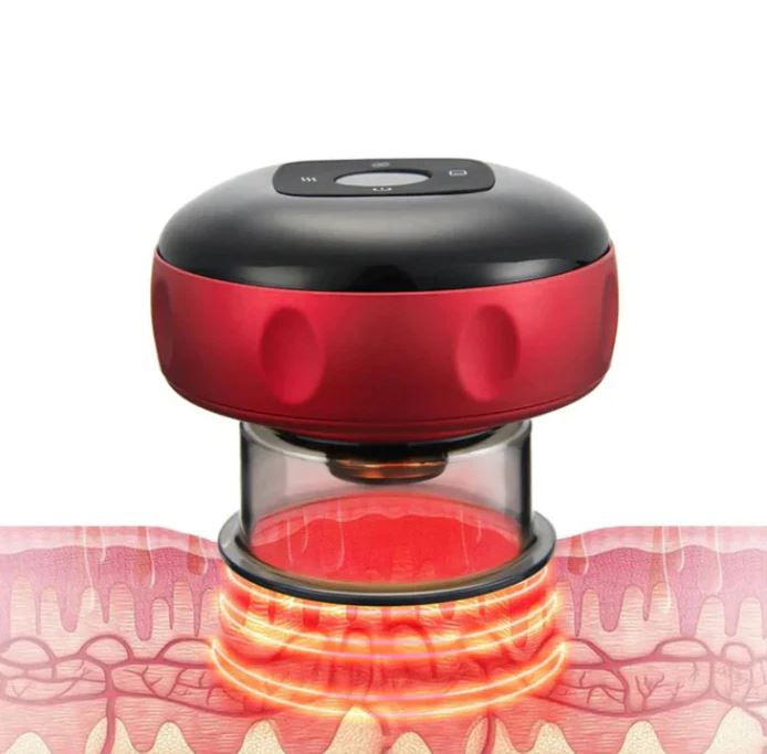 The Ultimate Smart Cupping Massager - Koyers