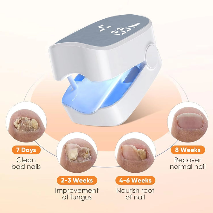 Rechargeable LED Nail Fungus Remover