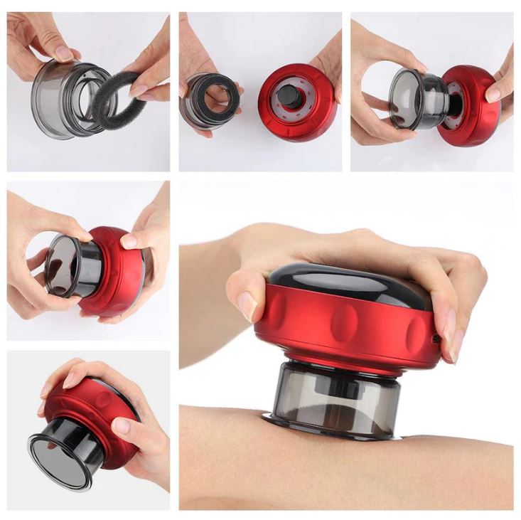 The Ultimate Smart Cupping Massager - Koyers