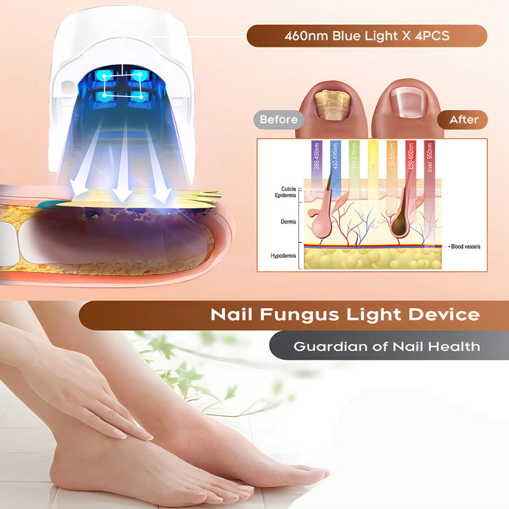 Rechargeable LED Nail Fungus Remover