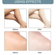 Dark Spot Whitening Cream - Koyers