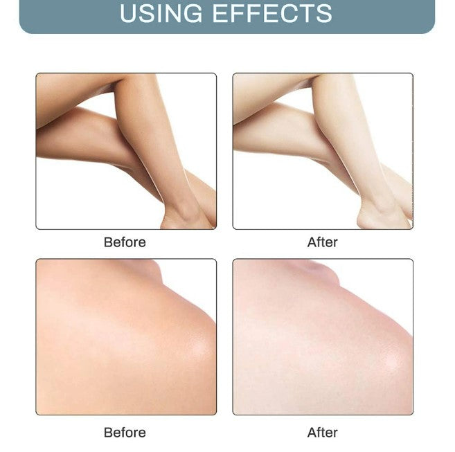 Dark Spot Whitening Cream - Koyers