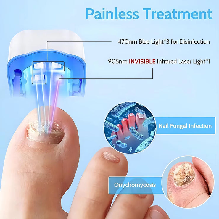 Rechargeable LED Nail Fungus Remover