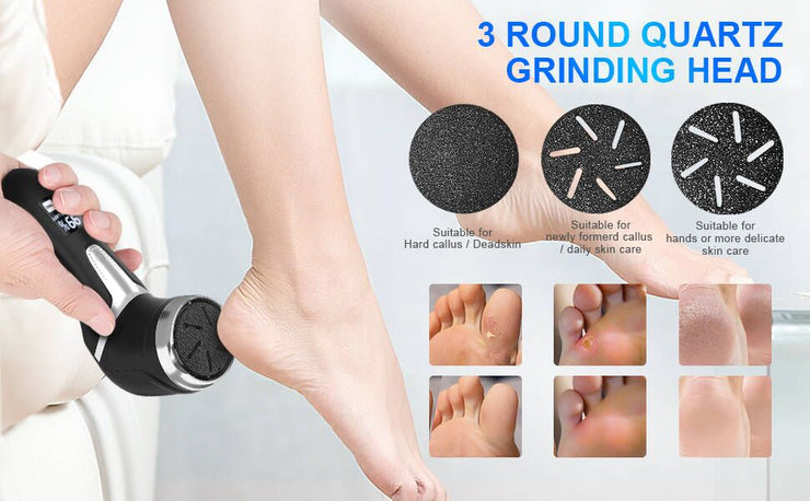 Rechargeable Electric Foot Scrubber – LCD Callus Remover with Vacuum & Waterproof Design