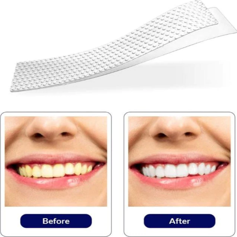 Professional 5D Teeth Whitening Strips - Koyers