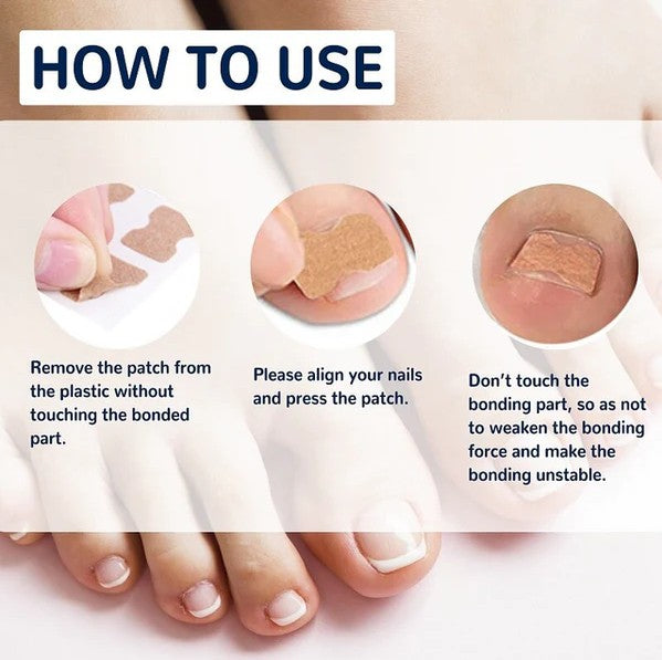 HealPatches - Correction Patch for Healthy Nails - Koyers